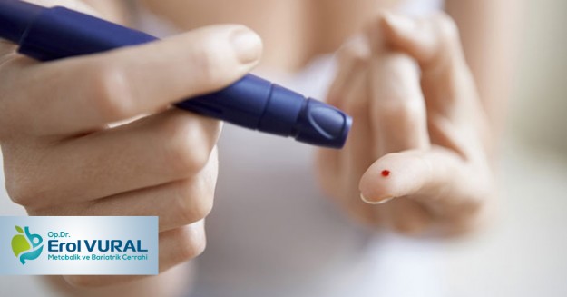 Seker_Hastalıgi_Ameliyati_İle_Obezite_Tedavi_Edilebilir_Mi