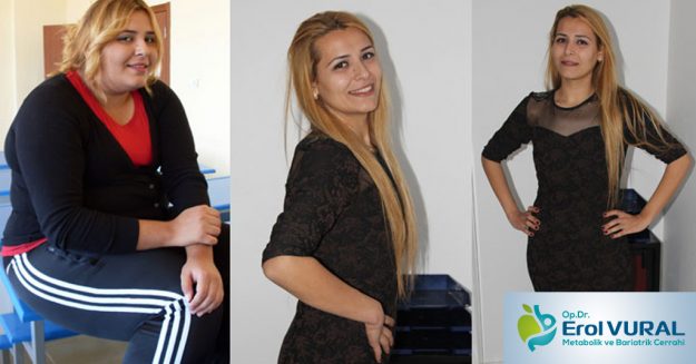 tup_mide_ameliyati_sonrasi_yasam