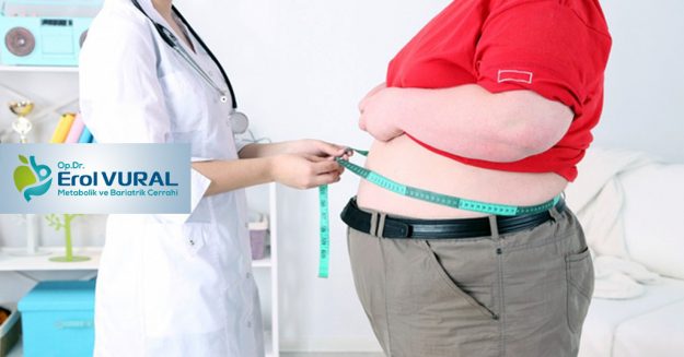 Obezite_Cerrahisi_Kimlere_Uygulanir