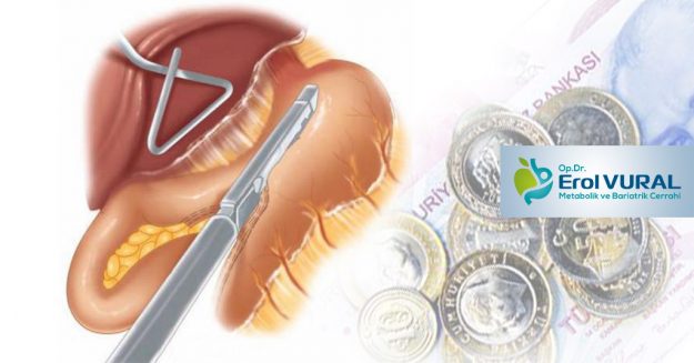 Tüp_Mide_Ameliyati_Maliyetli_Bir_Ameliyat_Mi