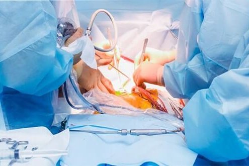 laparoskopi-ameliyat-laparoscopic-2